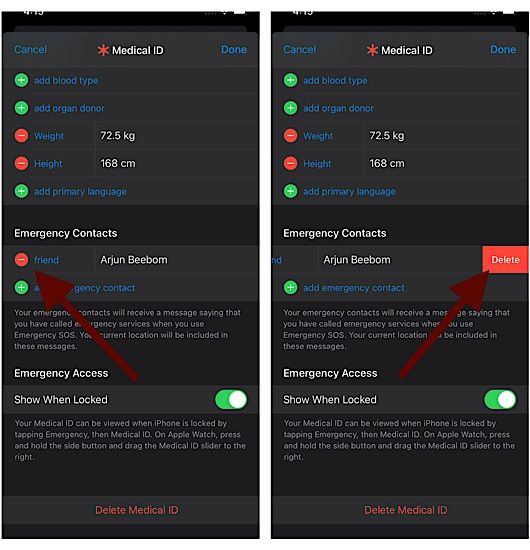 Comment supprimer un contact d'urgence sur Apple Watch et iPhone